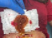 Tolak Balikan, Wanita Asal Nias Jadi Korban Penikaman di Medan