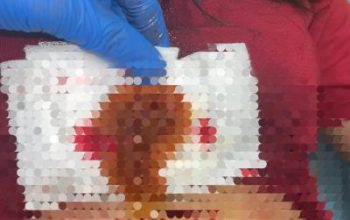 Tolak Balikan, Wanita Asal Nias Jadi Korban Penikaman di Medan