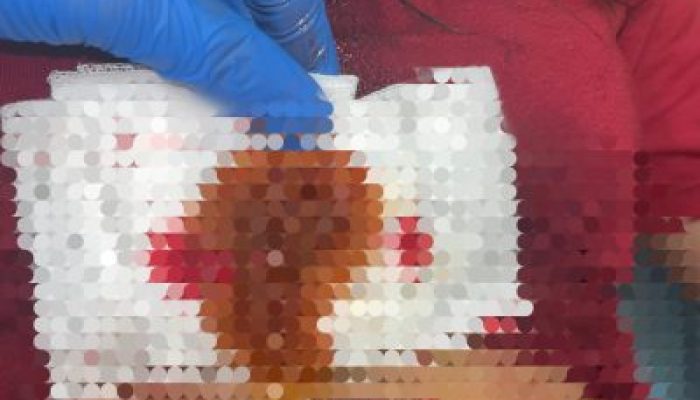 Tolak Balikan, Wanita Asal Nias Jadi Korban Penikaman di Medan