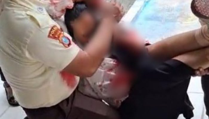 Diserang Saat Sempro, Mahasiswi UIN Suska Riau Alami Luka Serius